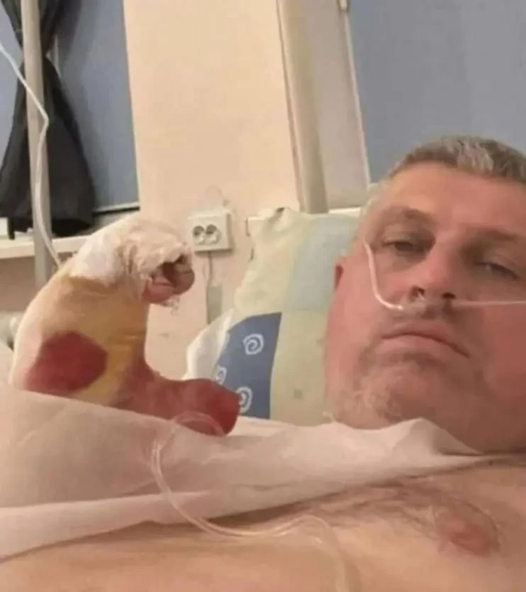 Осквернивший мемориал героям ВОВ в Судже литовский националист лишился пальцев из-за детонации неустановленного устройства