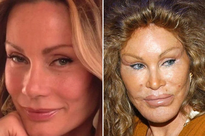 Как менялась женщина-кошка Джоселин Вильденштейн: умерла самая известная в мире жертва пластики