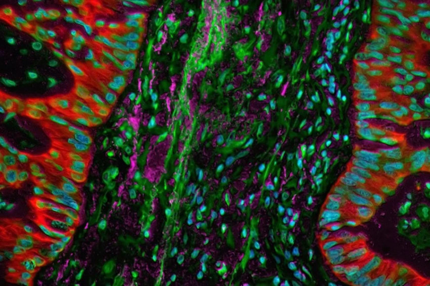 Новый краситель стал прорывом в визуализации глубоких тканей и терапии рака