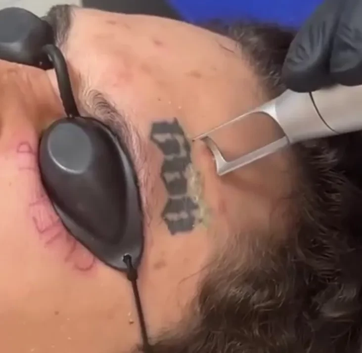 Моргенштерн* удалил татуировки с лица и почистил соцсети