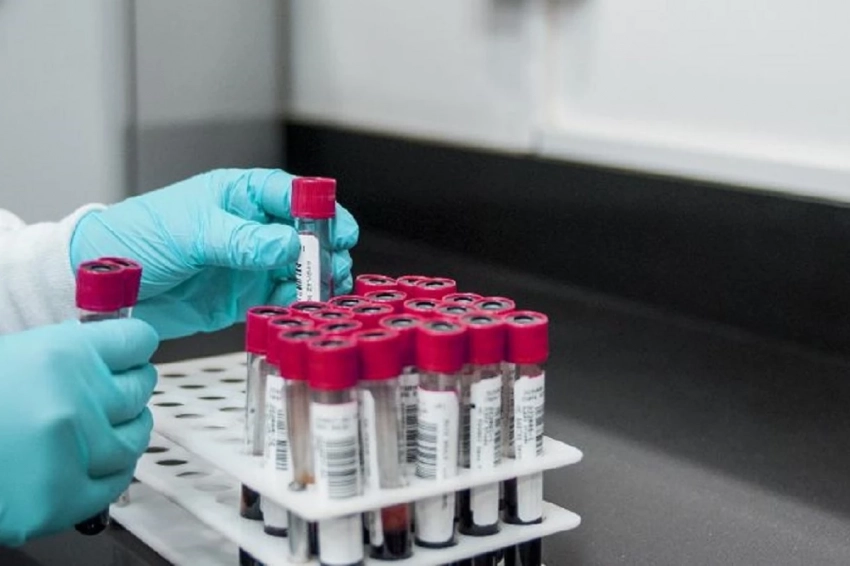 Вирус Кэмп-Хилл может спровоцировать масштабную эпидемию в Америке