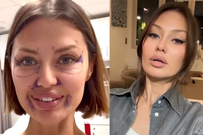 «Феерическая ложь!»: на Викторию Боню набросились подписчики после рекламы чудо-капельниц