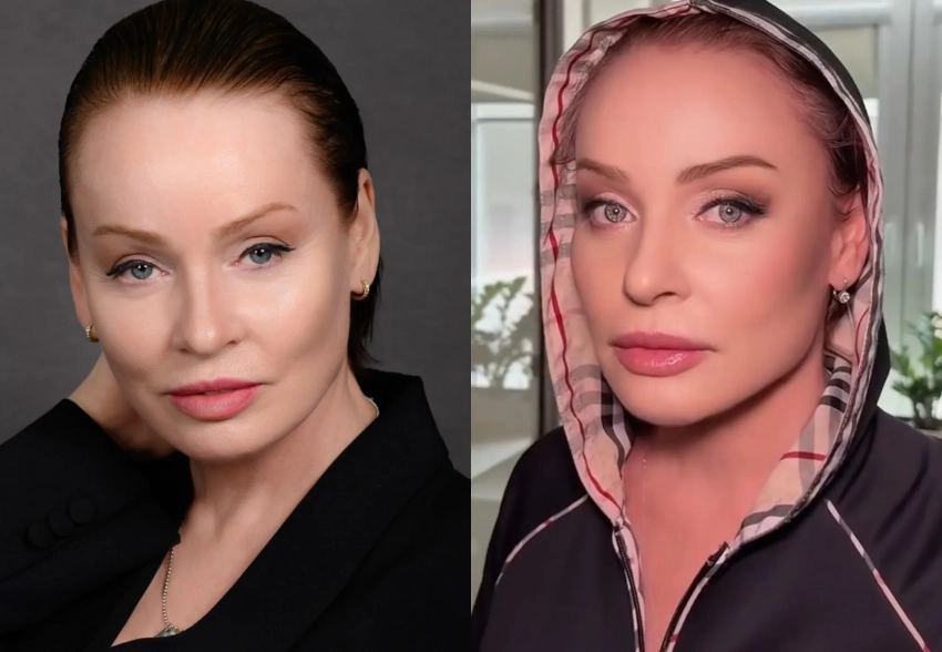 "Это вообще другой человек". В сети обсуждают "помолодевшую" актрису Жанну Эппле после пластики