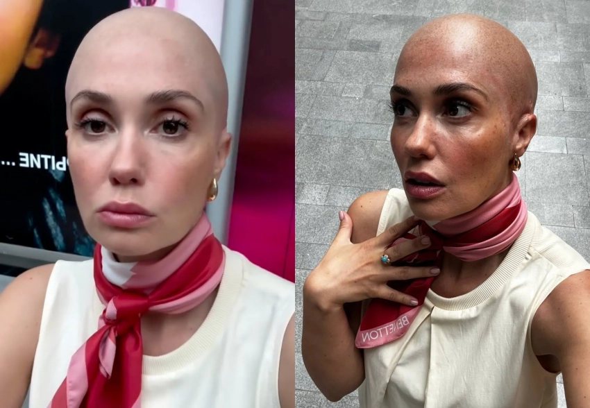 "Сожгли волосы". Беременная Агата Муцениеце заявила, что побрилась налысо перед свадьбой из-за неудачной завивки