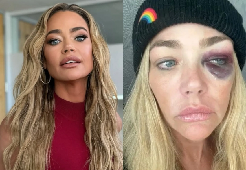 "Душил меня и угрожал убить". Дениз Ричардс обвинила мужа в домашнем насилии