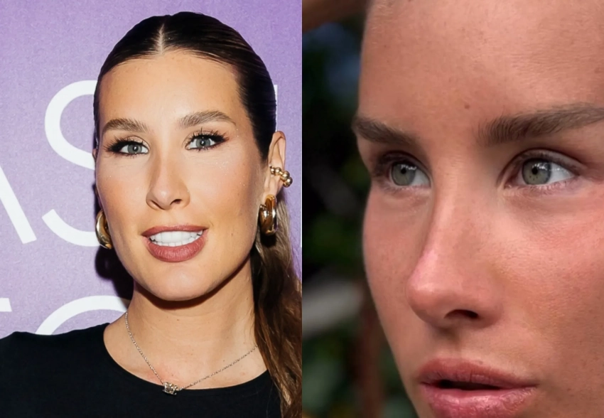 "Нос теперь — произведение искусства". Кети Топурию заподозрили в пластической операции