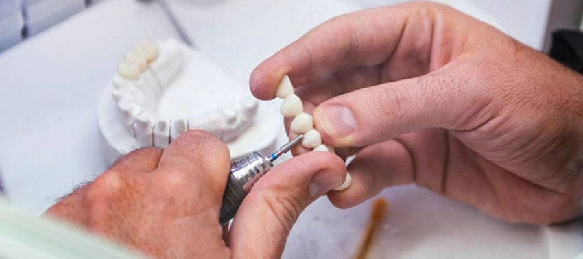 Современные подходы к лечению зубов и протезированию