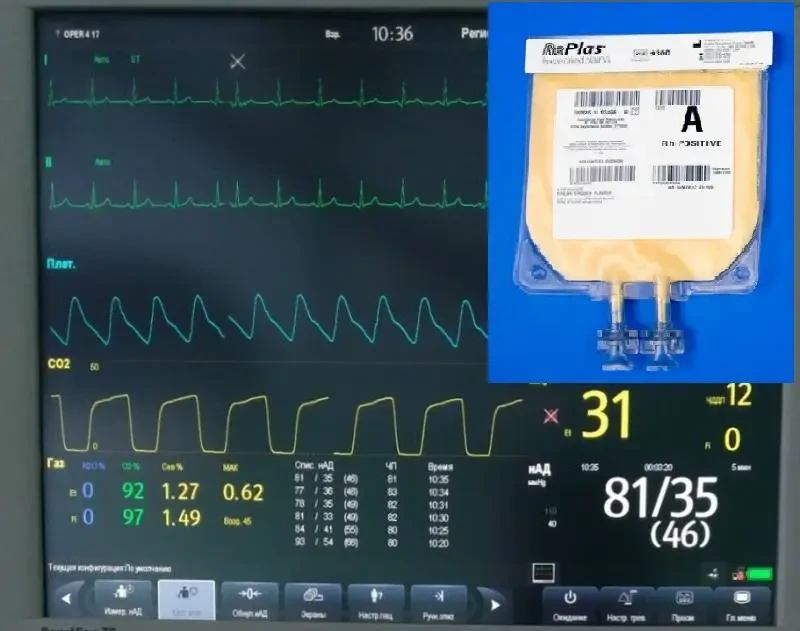 Сухая лиофилизированная плазма крови и СВО. Применение, технологии, ценообразование, логистика