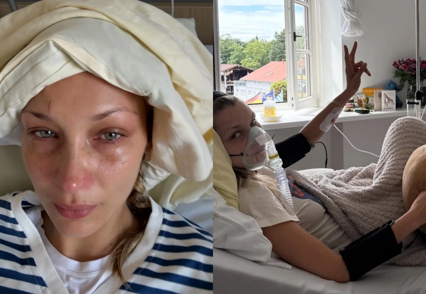 Белла Хадид рассказала об обострении болезни Лайма