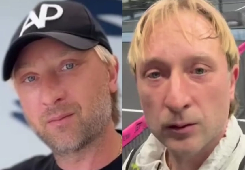 Евгений Плющенко показал, как выглядит спустя три месяца после блефаропластики