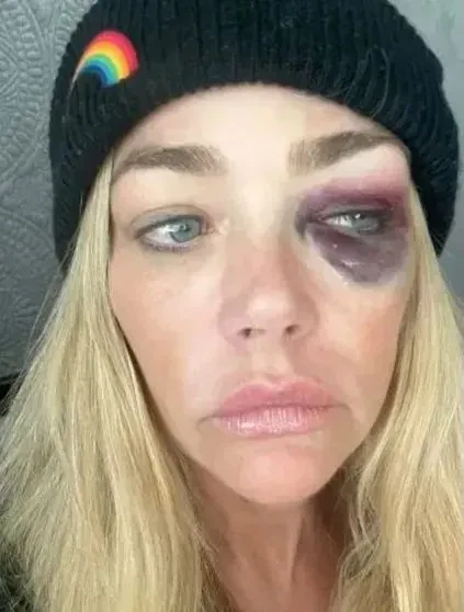 Кричал и спорил с шерифом: бывшего мужа Дениз Ричардс арестовали по обвинению в домашнем насилии