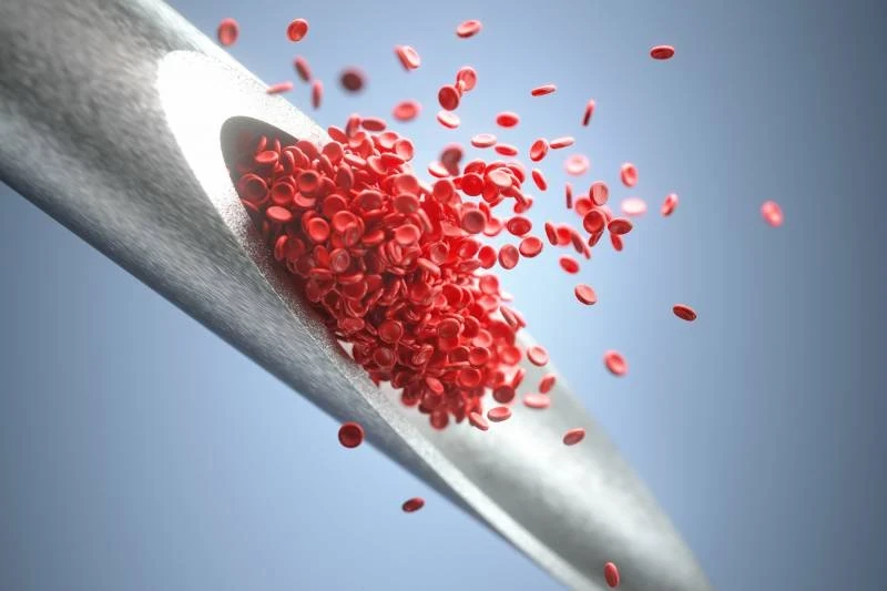 Тромбы под угрозой: как распознать опасные симптомы за две недели