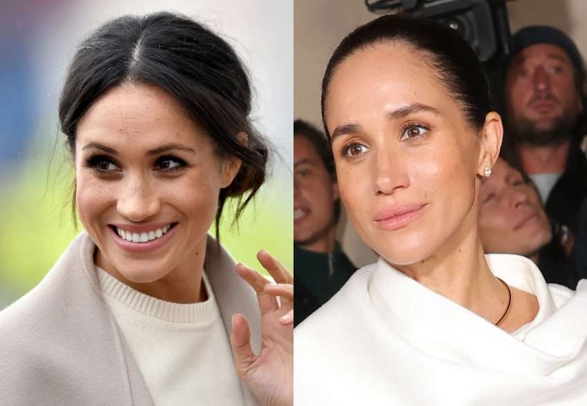 "От прежнего лица ничего не осталось". В сети считают, что Меган Маркл сделала пластическую операцию