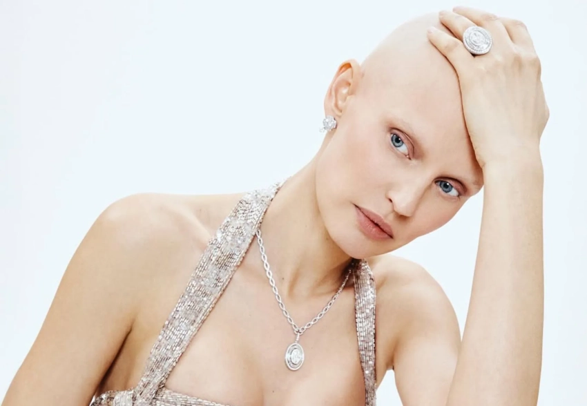 "Я не самая молодая и не самая стройная". Модели Бьянке Балти, которая борется с раком, отказали в участии в показе Victoria's Secret